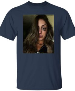 Battle Damage Britt Baker Shirt Shirt Sweatshirt Long Sleeve Hoodie Tank Mug 5 Battle Damage Britt Baker Shirt Shirt Sweatshirt Long Sleeve Hoodie Tank Mug 6